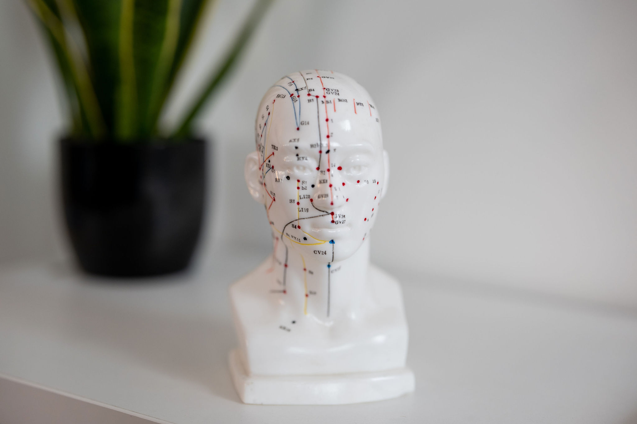 Acupuncture point model at SPORTS CLINICAL